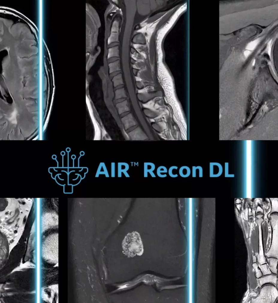 Sharper scans with SIGNA? Hero 3.0T MRI