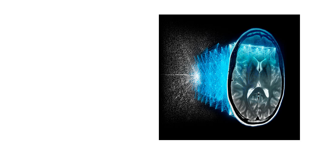 SIGNA-1-5-AIR-Recon-DL-resources-Full-Width