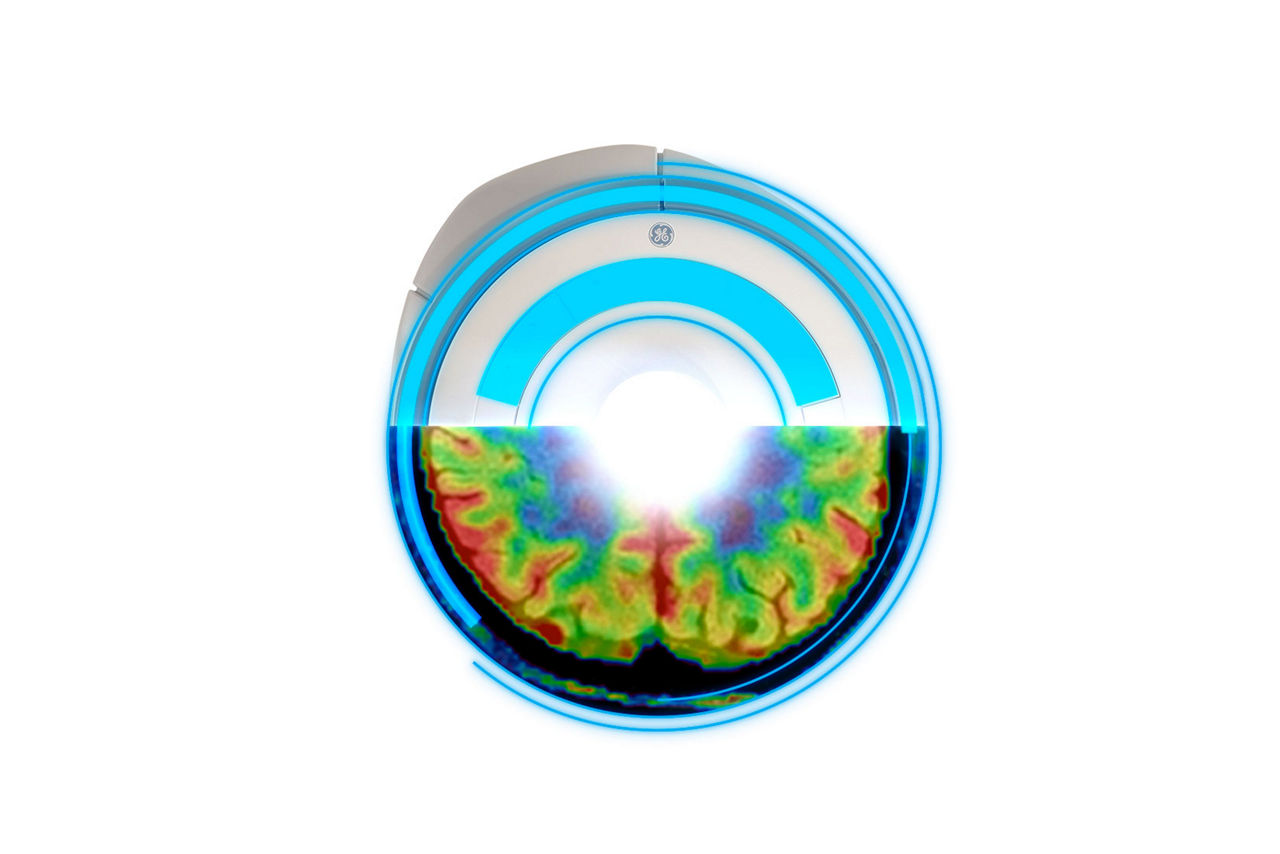 Signa-1-5-signa-continuum