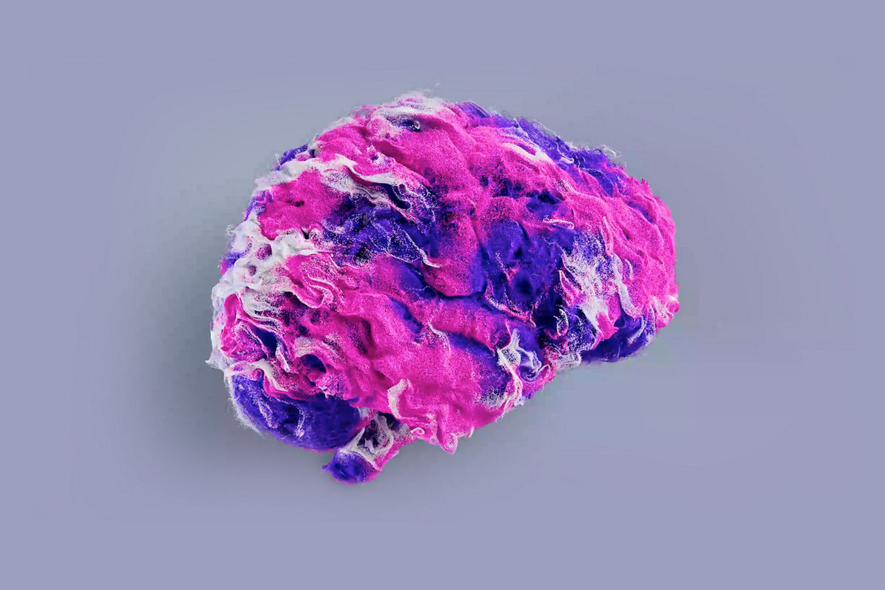 Signa 3 T AIR Recon DL