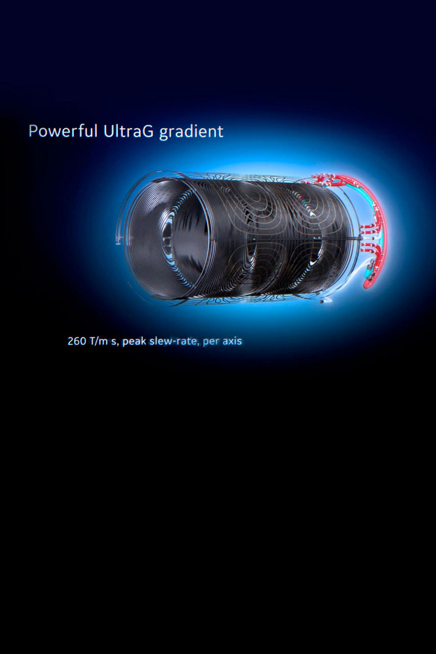 SIGNA-7T-feature-hero_image-2