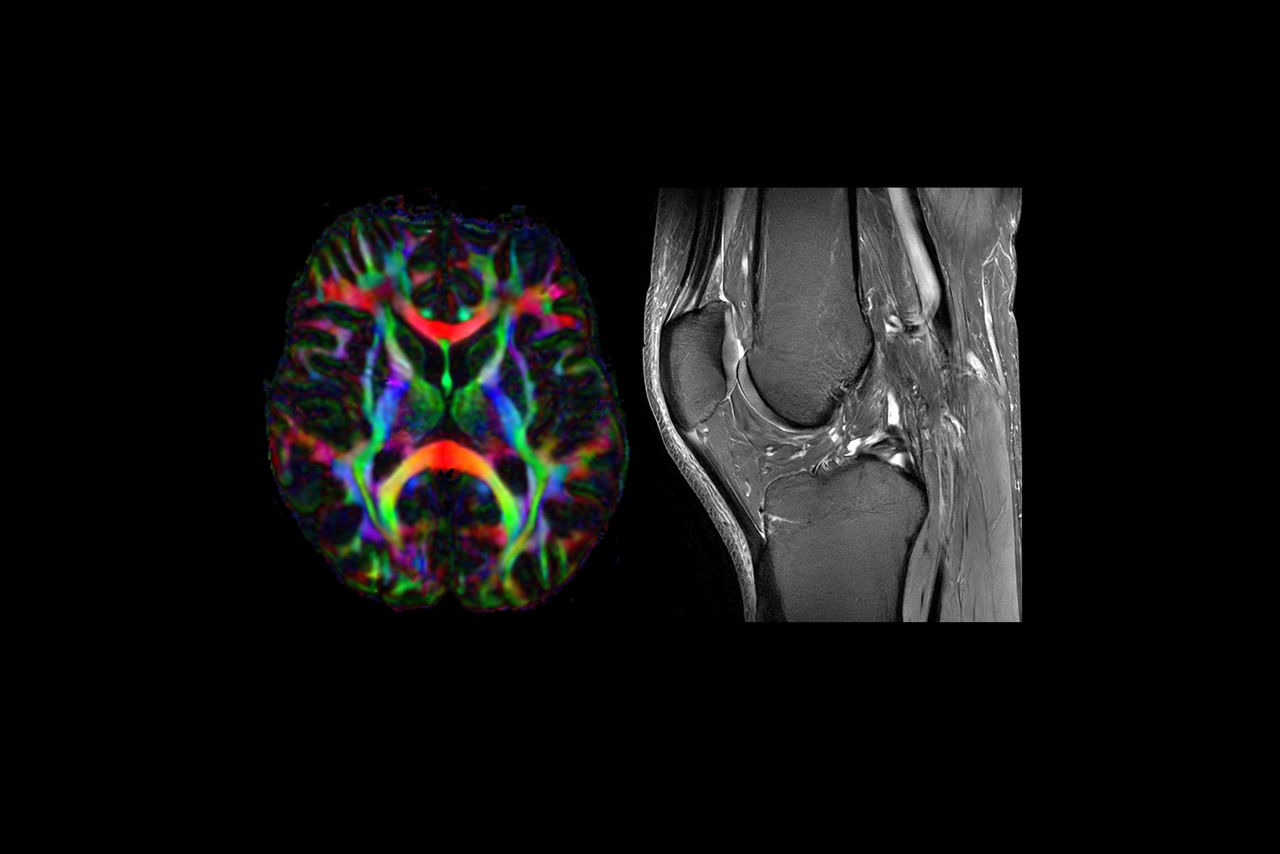 signa-7t-mri-scanner-feature-hero-1-ci-en
