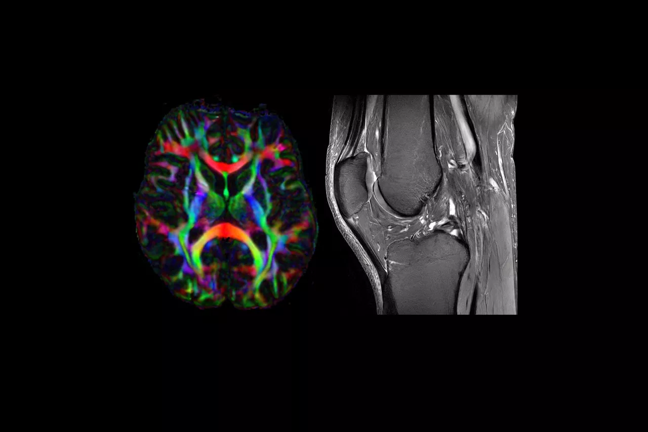 signa-7t-mri-scanner-feature-hero-1-ci-en