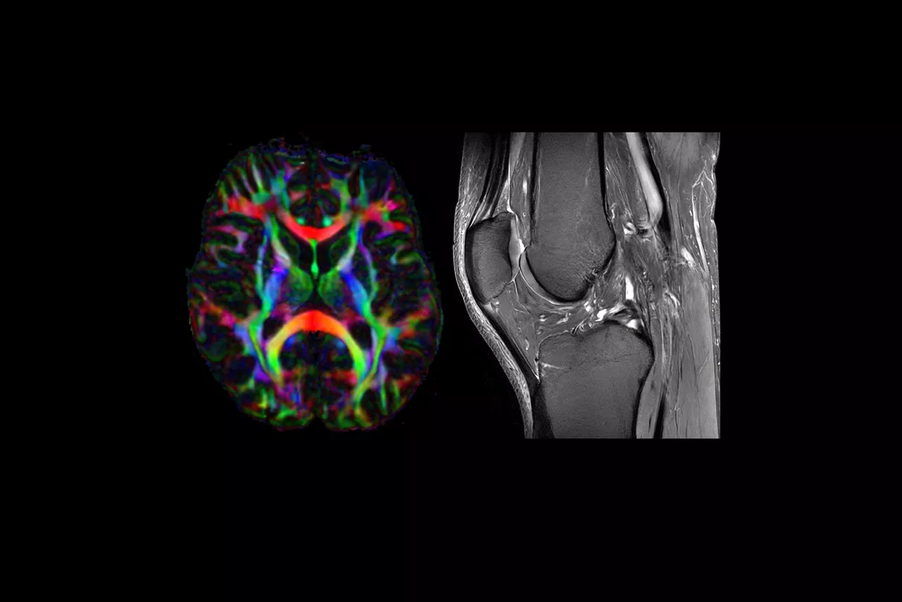 signa-7t-mri-scanner-feature-hero-1_1440x960 v2
