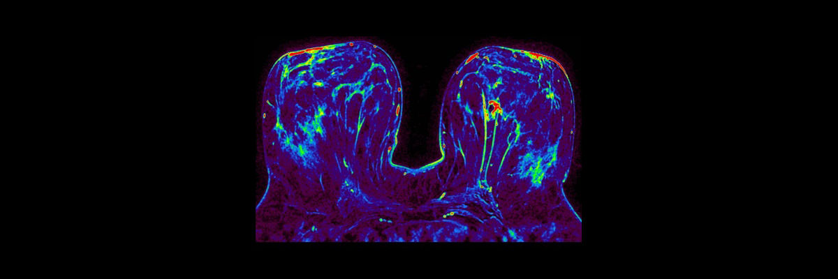 signa-architect-clinical-images-oncoworks-fspgr-ax-dynamic-thumbnail