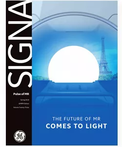 SIGNA-Artist-SIGNA-Pulse-of-MR-article-Feature-Cards-Half-Width03