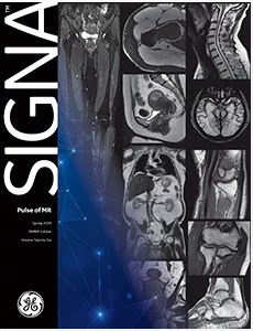 SIGNA-Artist-SIGNA-Pulse-of-MR-article-Feature-Cards-Half-Width04
