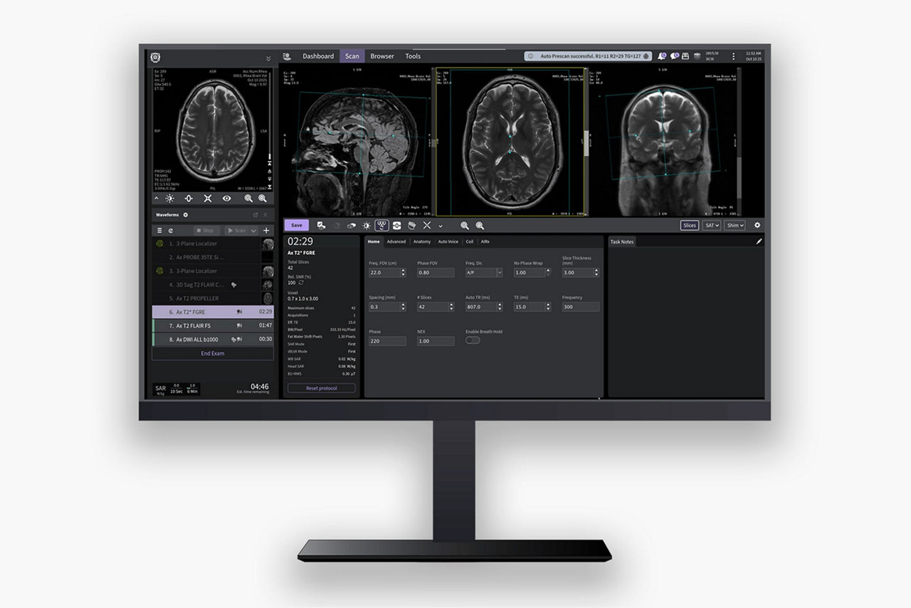 signa-bolt3t-wide-streamline-clinical-efficiency-ci-en