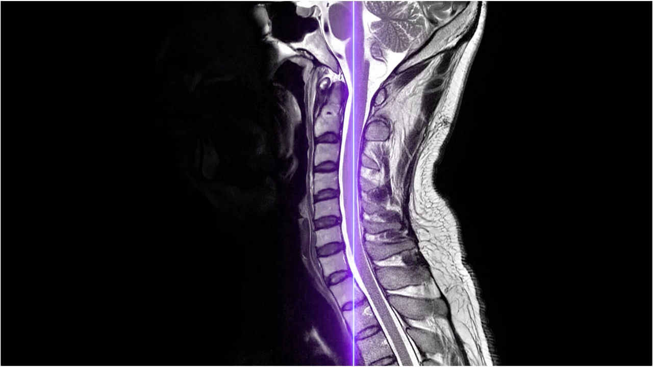 SIGNA Continuum Legacy MRI AIR Recon DL image