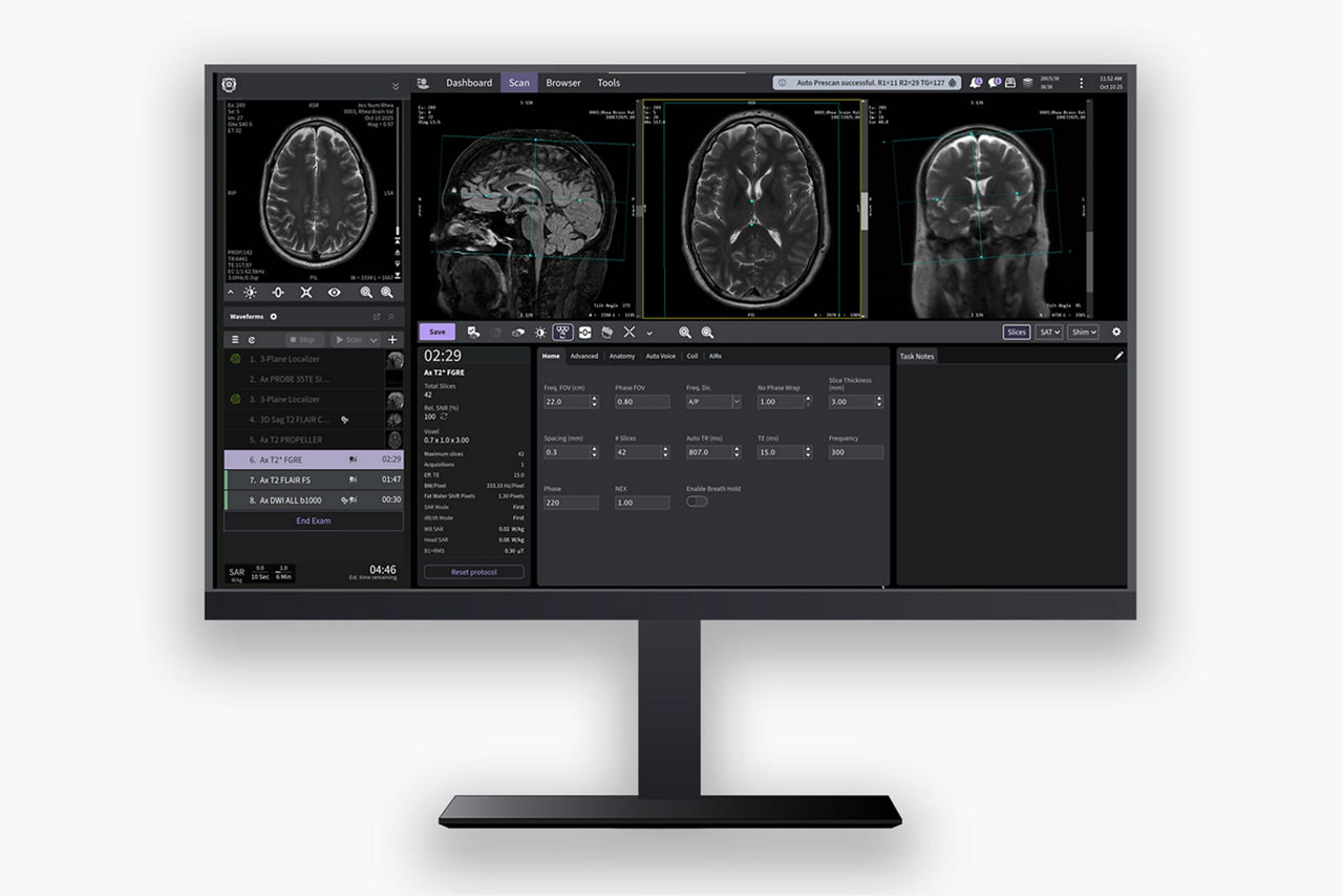 SIGNA-Feature-hero-3