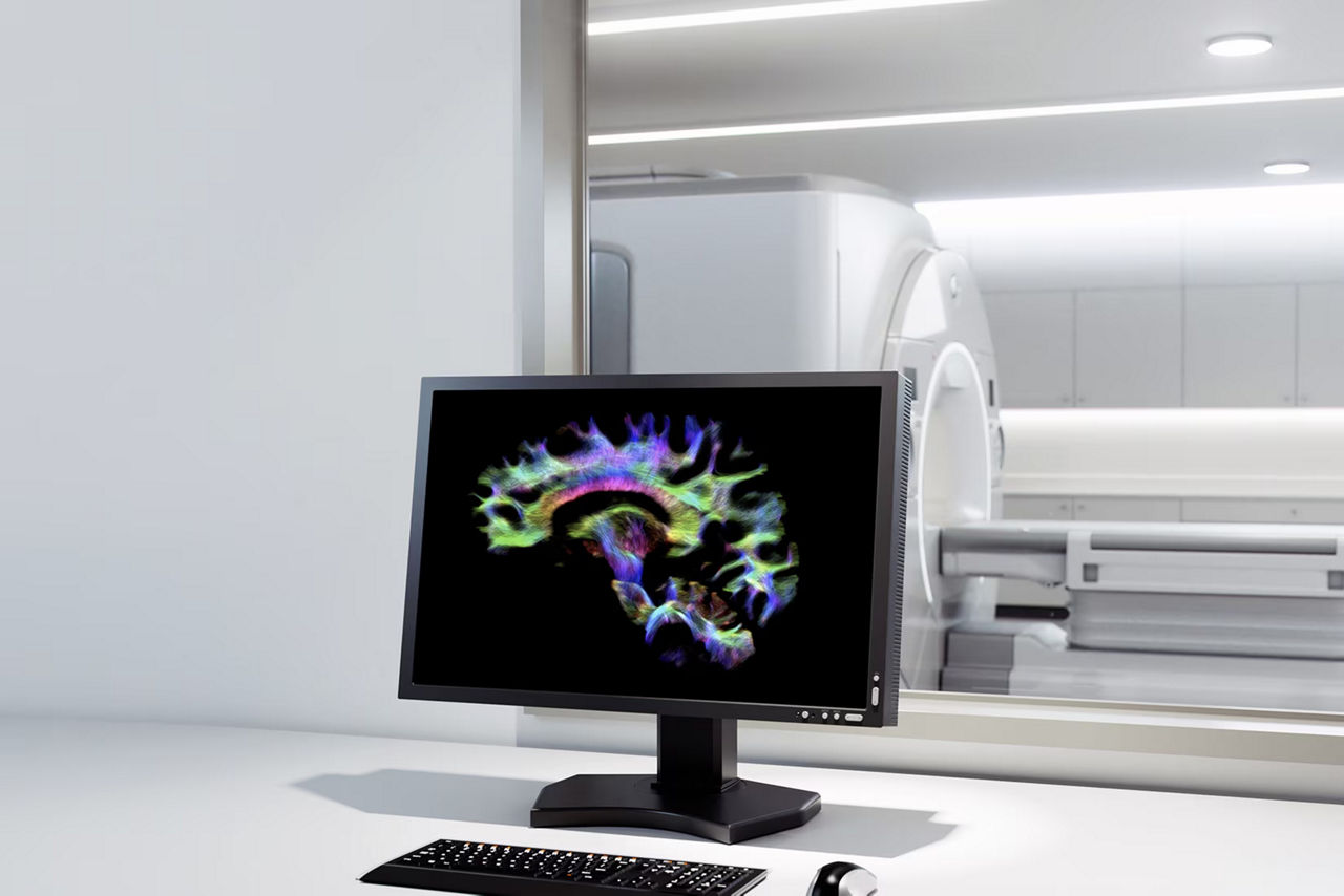 signa-mr-vision-groundbreaking-ba-en