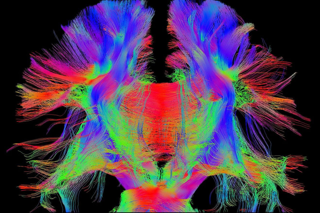 SIGNA-One-MRI-Feature-hero-4