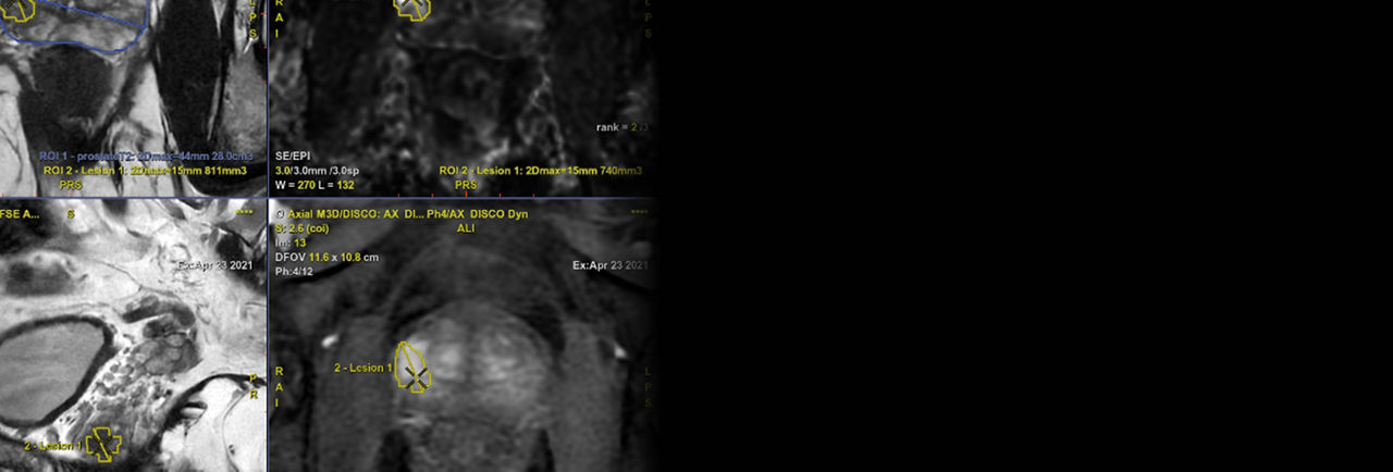 SIGNA-One-MRI-Featured content desktop