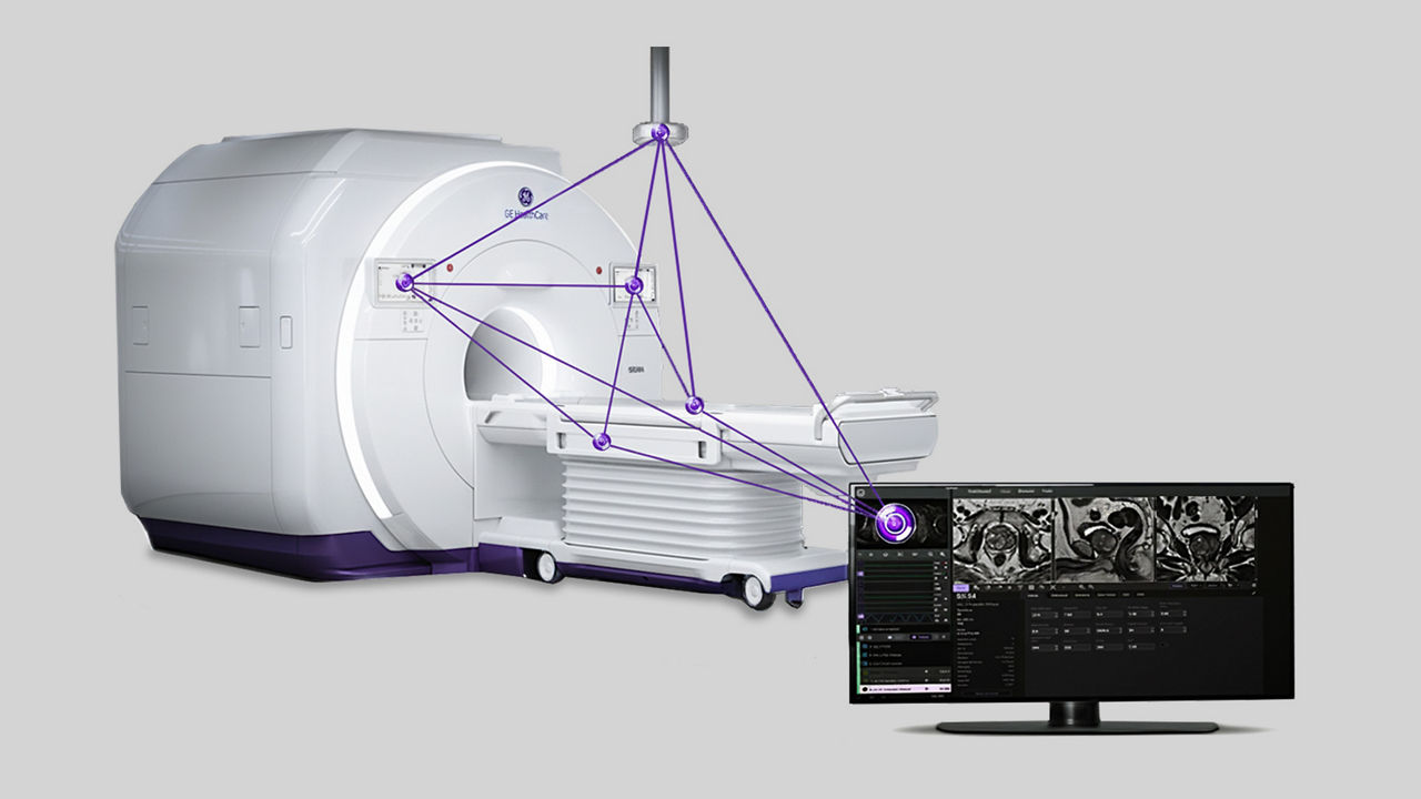SIGNA-One-MRI-Story gallery 1-desktop