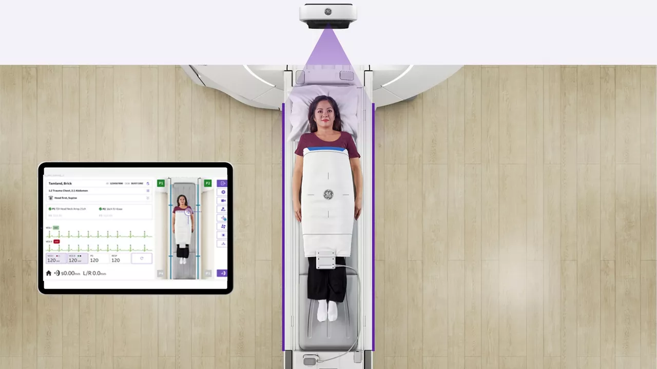 SIGNA-One-MRI-Story gallery 5-desktop