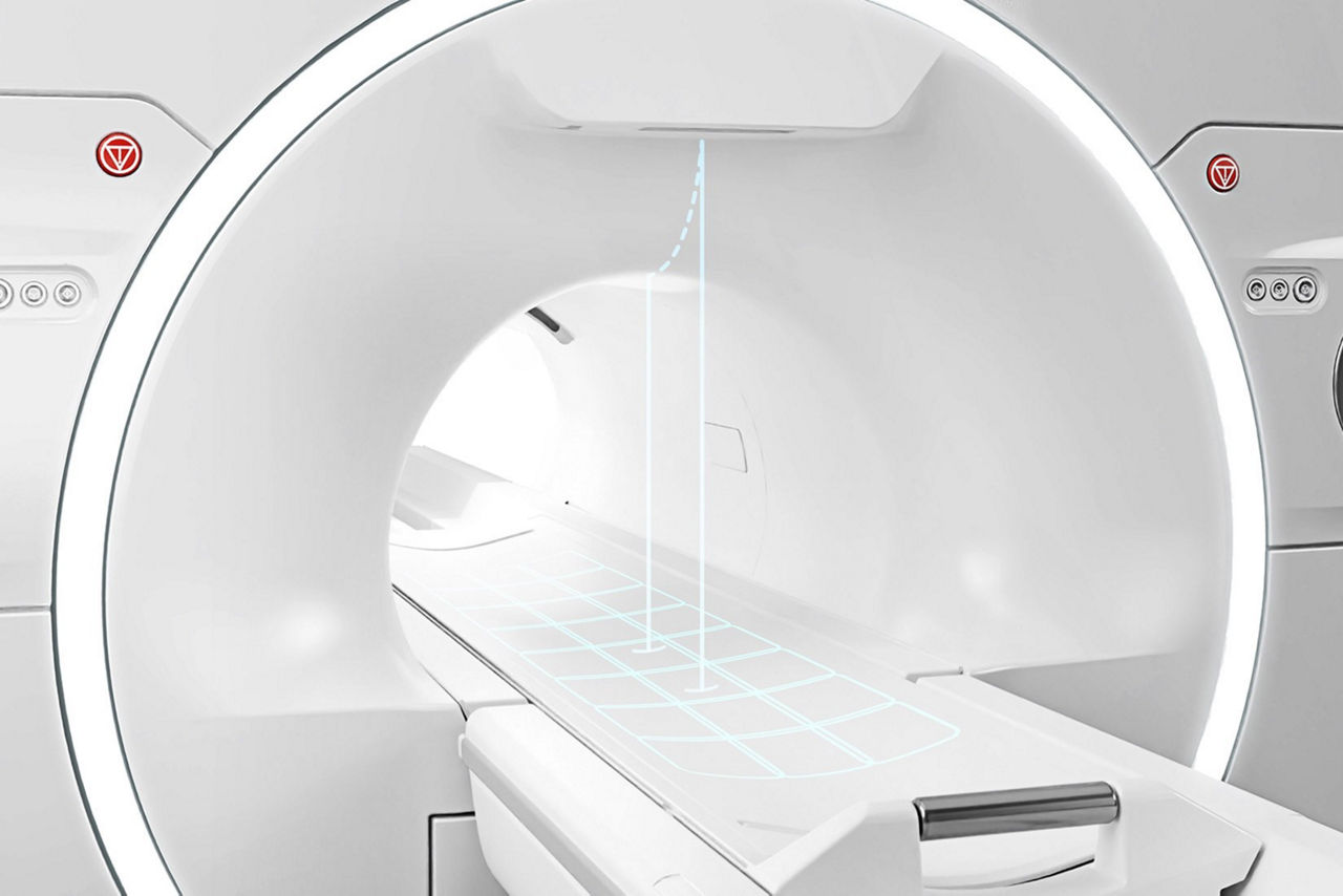 signa-patient-experience-ci-en