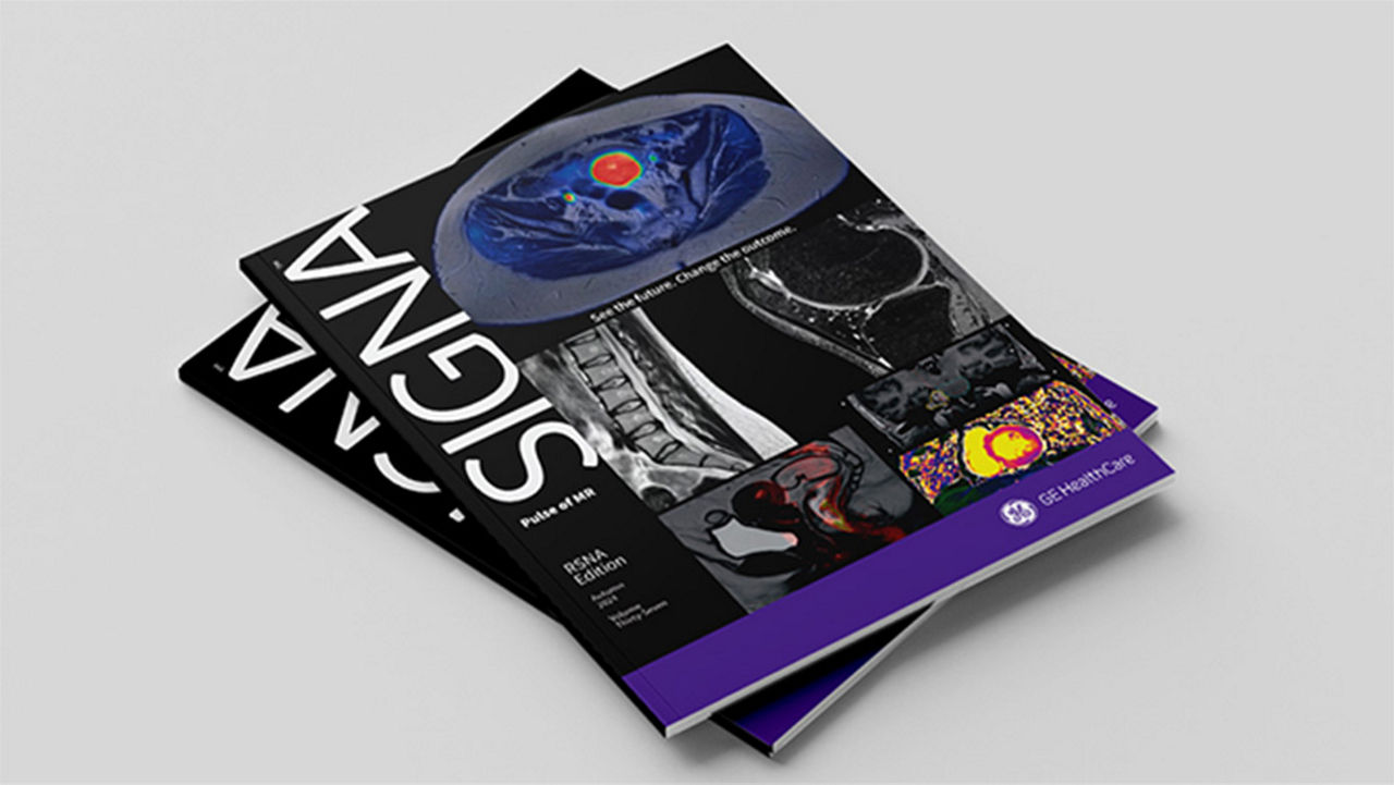 Cover page for Fall 2024 SIGNA Pulse of MR edition