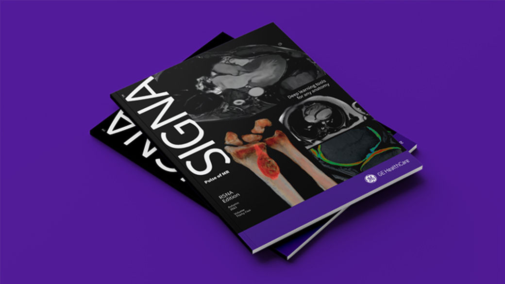 signa-pulse-desktop-1040x585