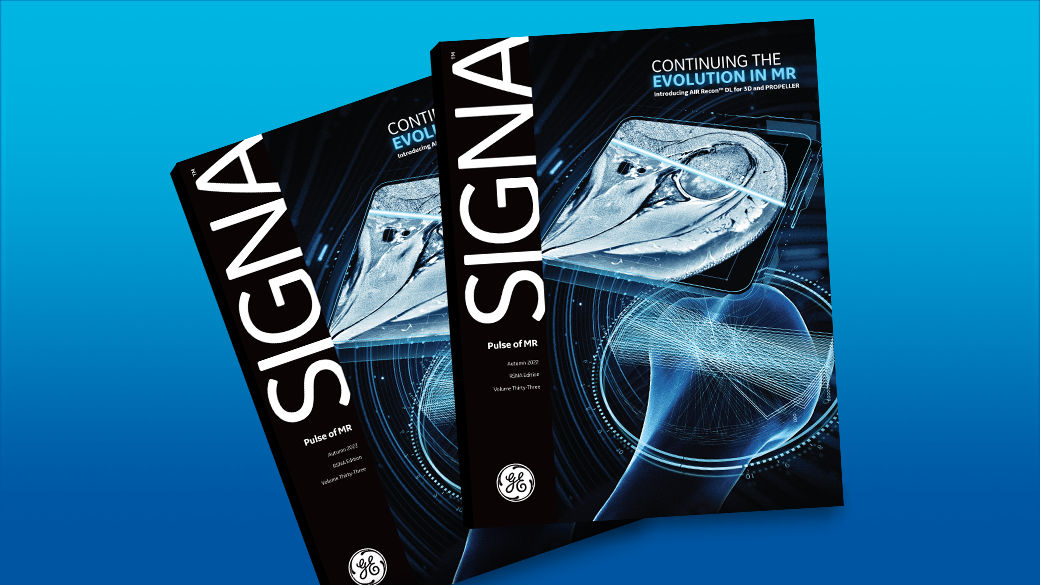 SIGNA Pulse of MR
