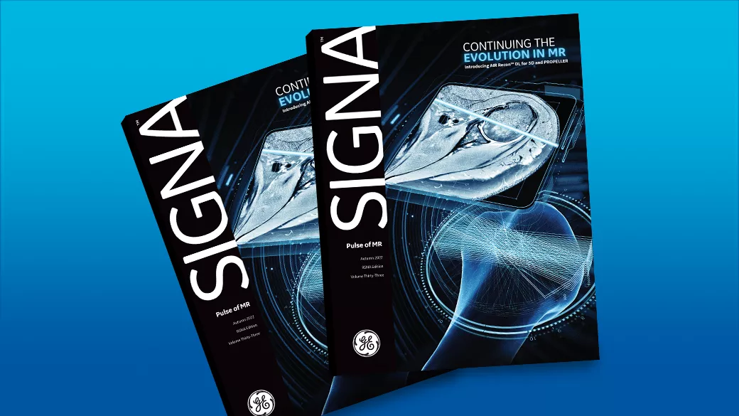 SIGNA Pulse of MR