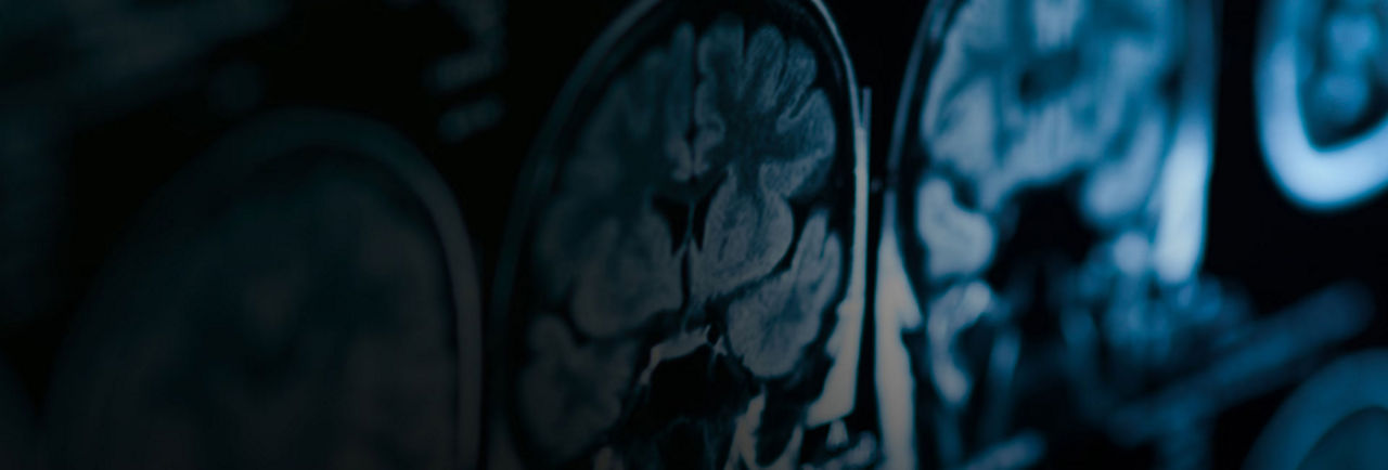 signa-sprint-wide-high-performance-flipped-ba-en