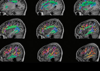 SIGNAPremierBrainDesktop-516x680