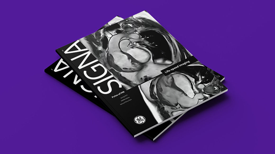 SIGNA Pulse of MR Spring 2023