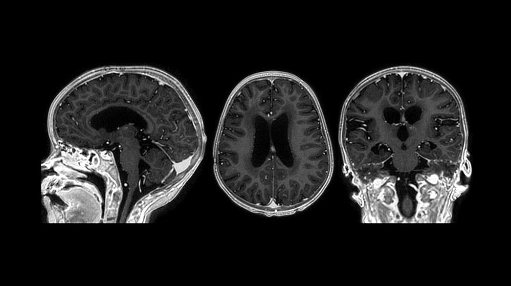 SilentScan1040-x-585