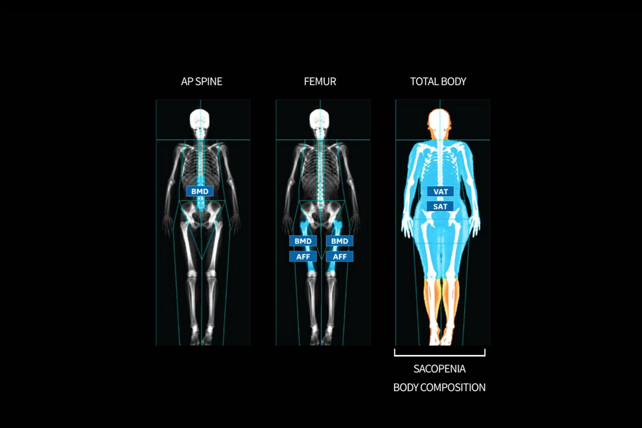 smarter-scanning-dxavision-ci-en