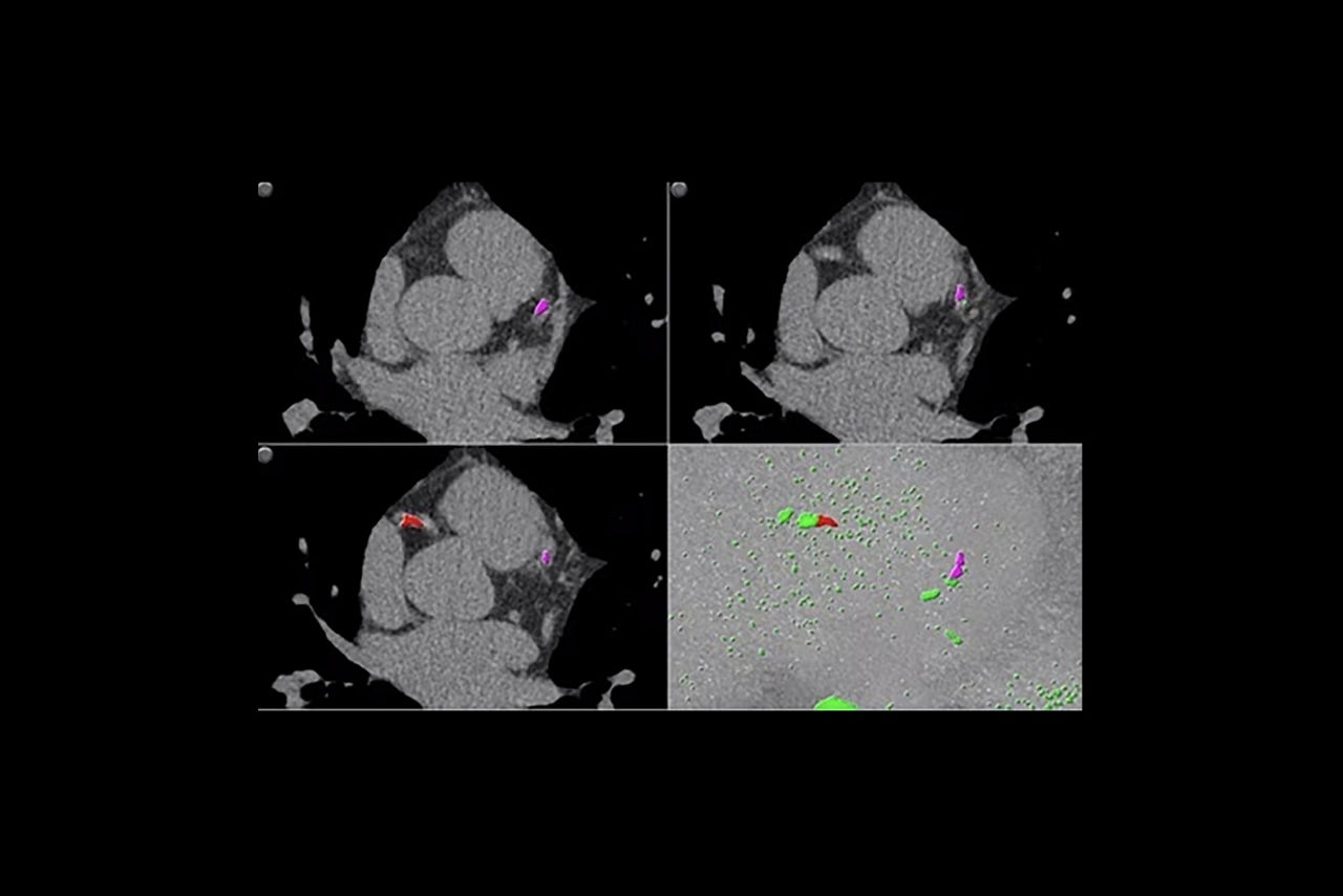 smartscore-4-desktop-ci-en