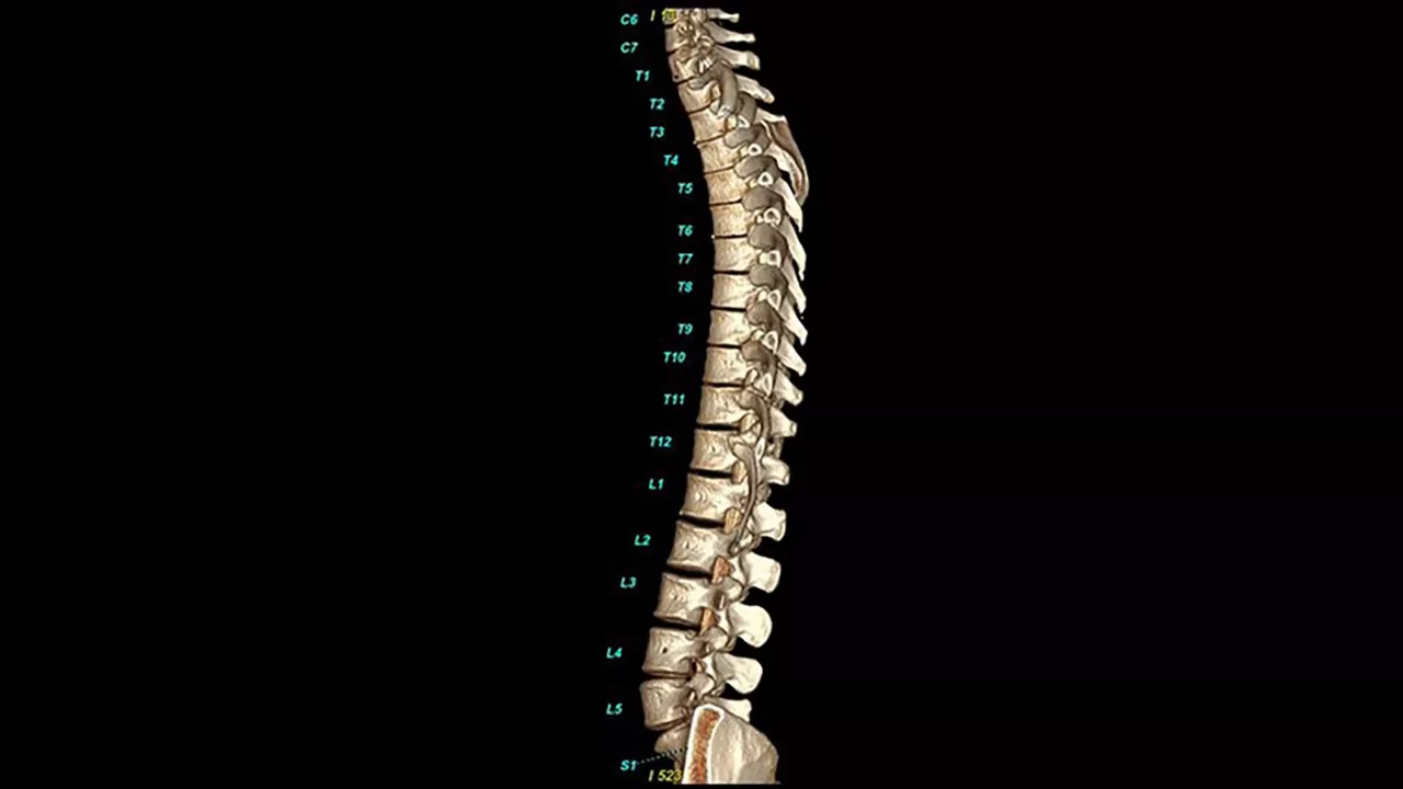 <p>Bone VCAR</p>

