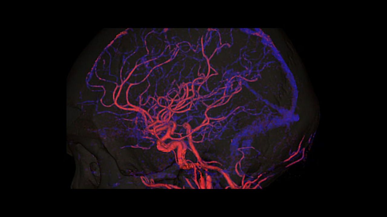 <p>Dynamic Shuttle</p>
