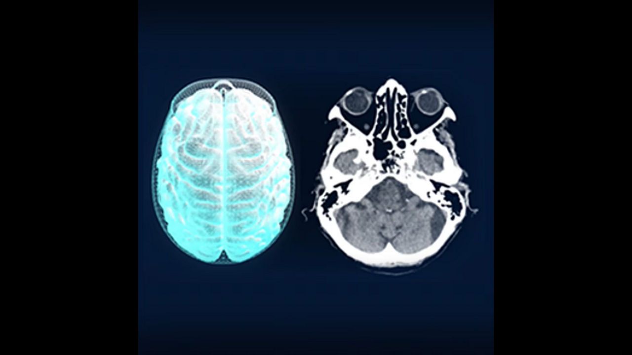 <p>Head Auto Views</p>
