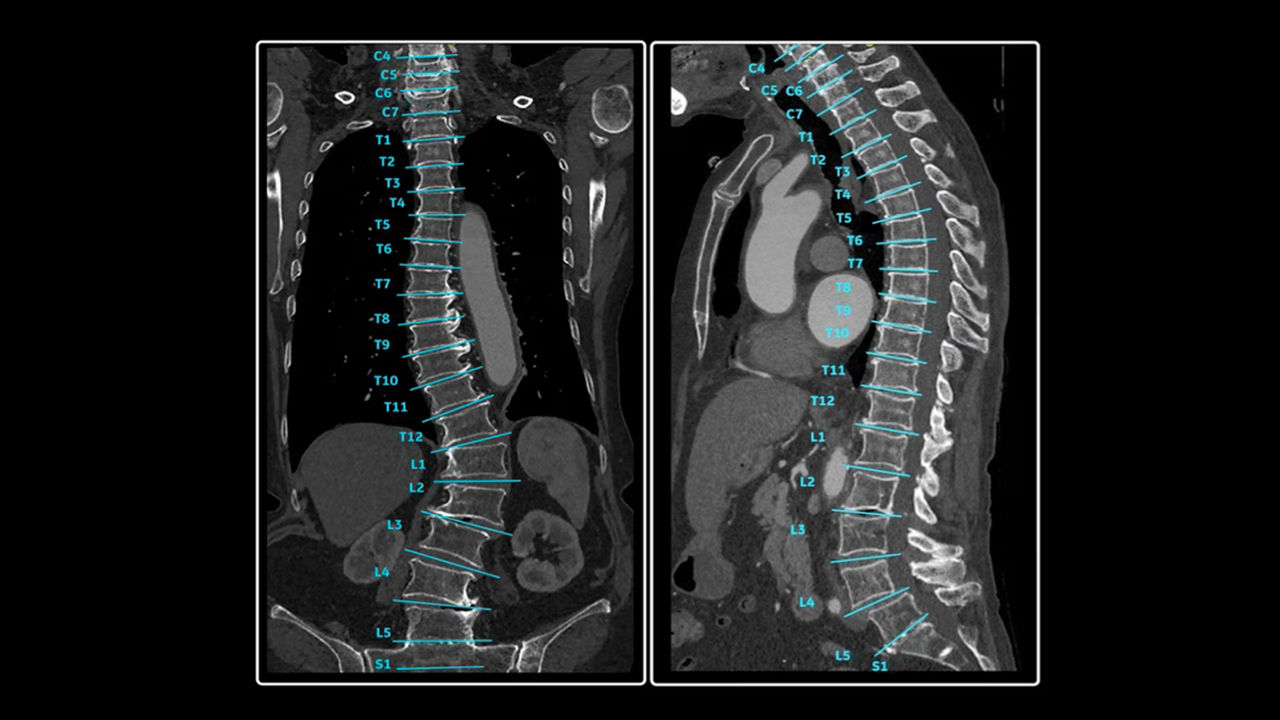 <p>Spine Auto Views</p>
