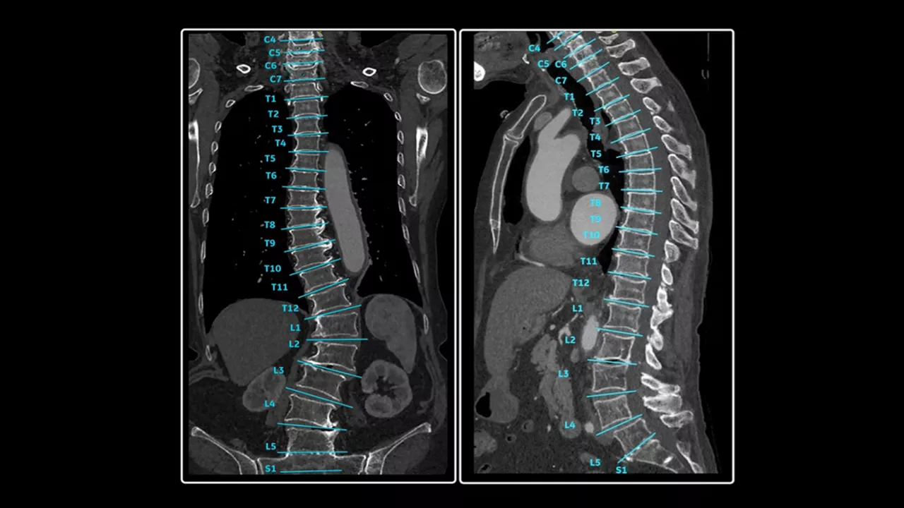 <p>Spine Auto Views</p>
