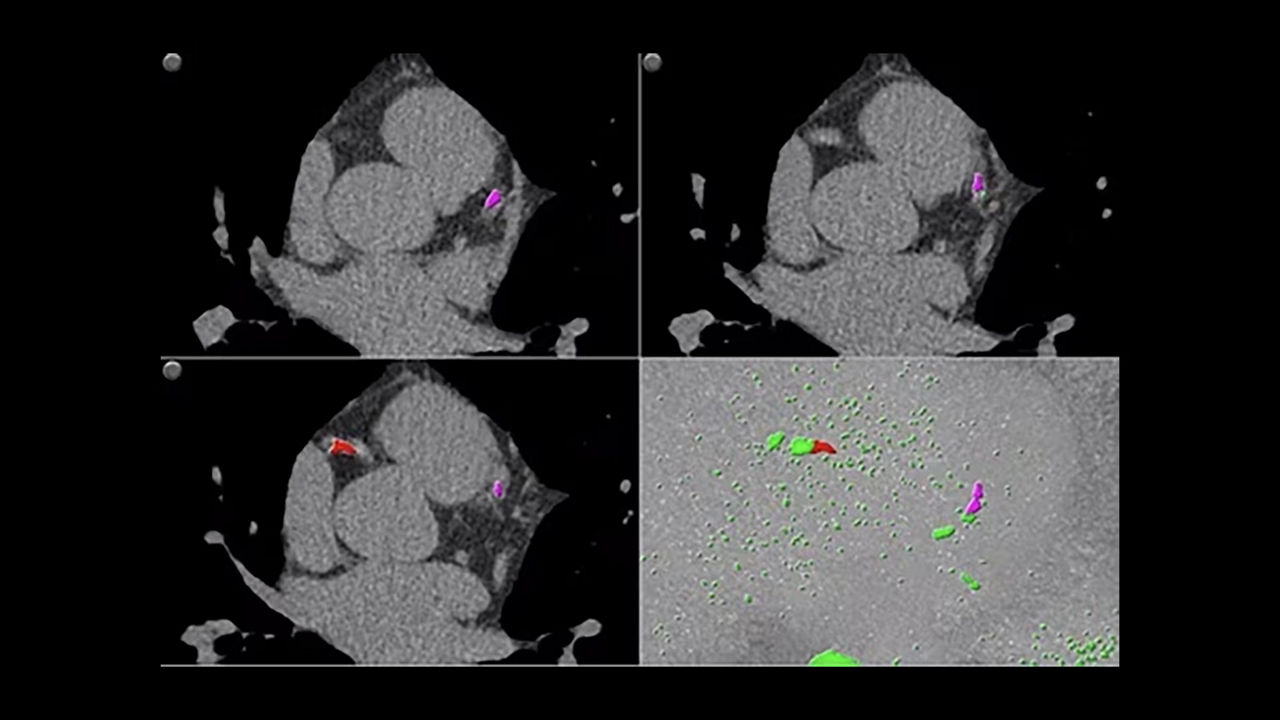 <p>SmartScore 4.0</p>
