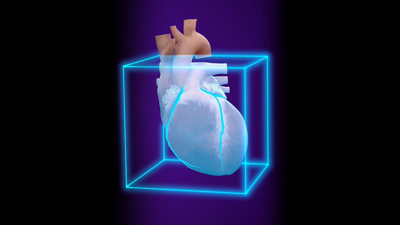 <p>SnapShot Freeze 2</p>
