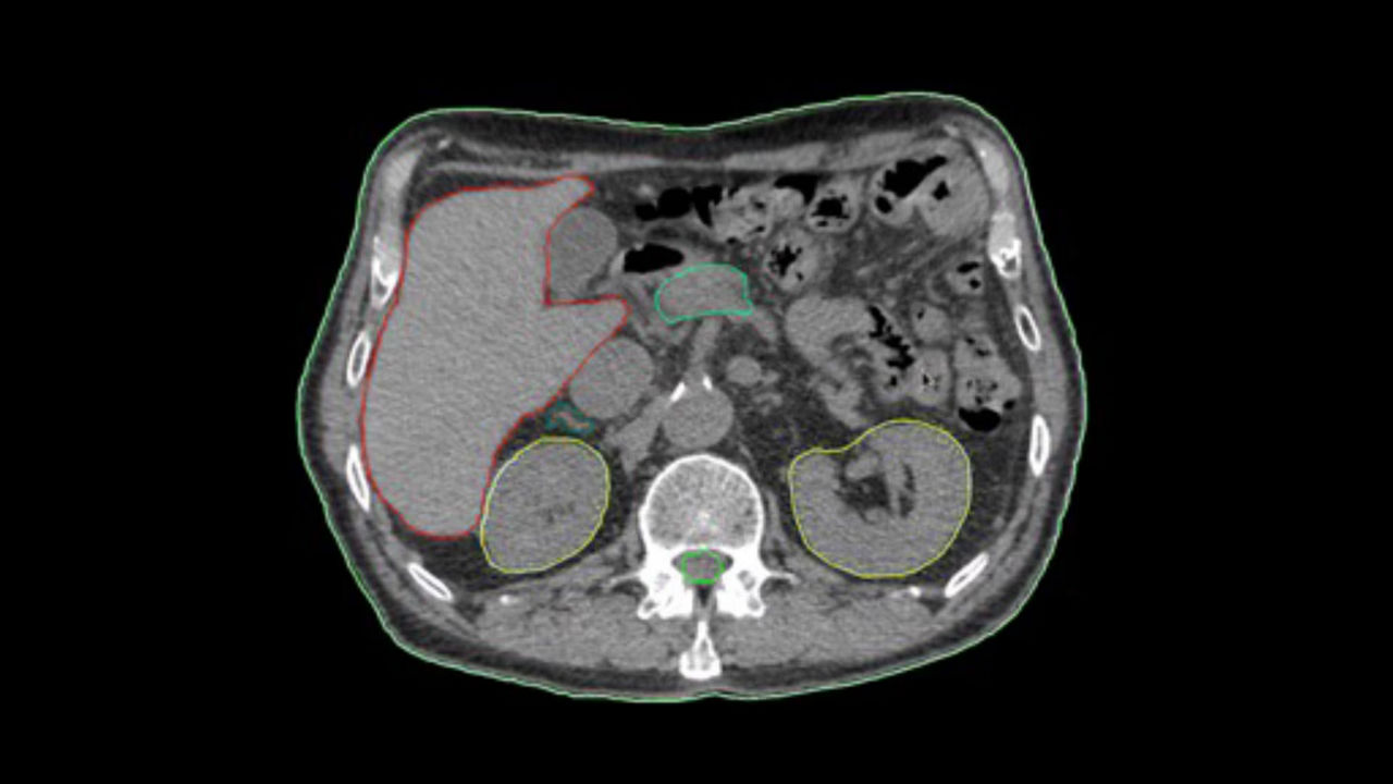 <p>Auto Segmentation</p>
