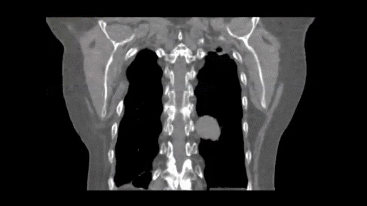 <p>Deviceless 4D</p>
