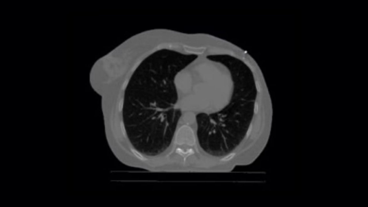 <p>Prospective Gating</p>
