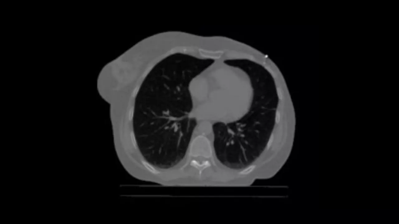 <p>Prospective Gating</p>
