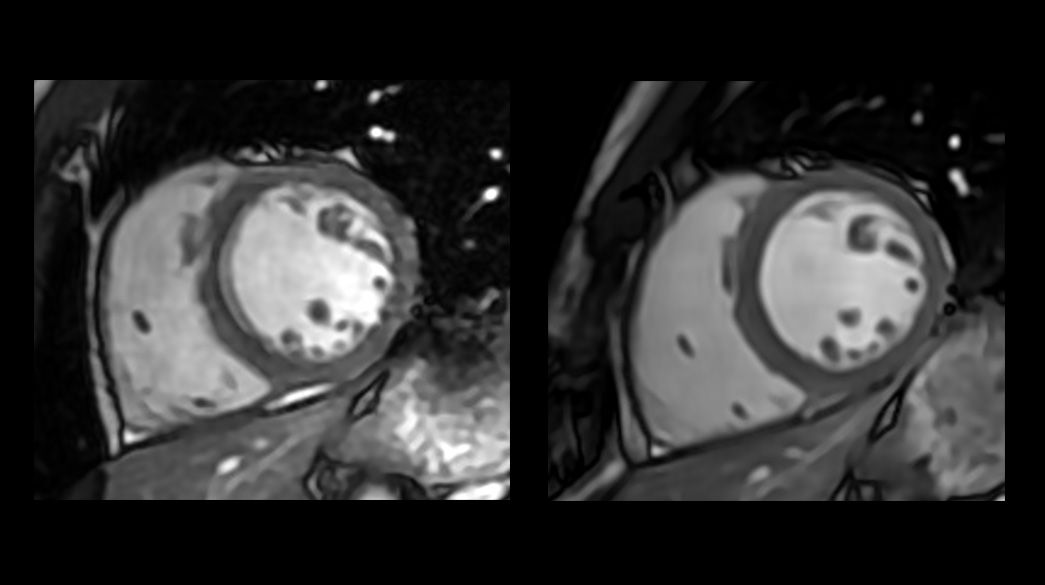 Sonic-DLCine1040-x-585