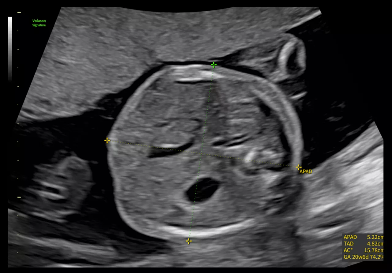 sonobiometry-ob-signature-18