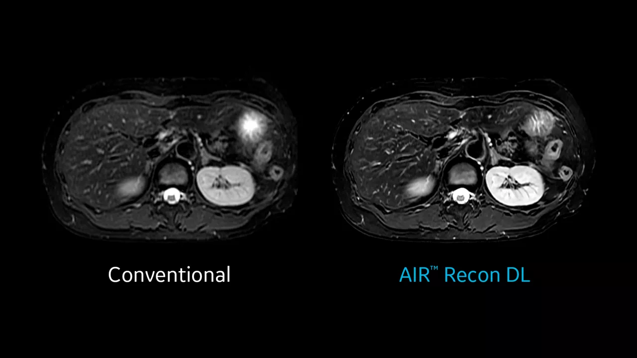 SP_Slide2_AIR Recon DL_1920x1080
