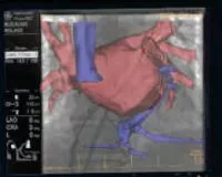specialty-electrophysiology-epvision-advancedapp.jpg