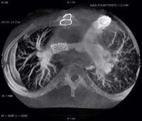 specialty-electrophysiology-innova_3d-advancedapp.jpg