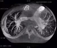 specialty-electrophysiology-innova_3d-advancedapp.jpg