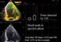 specialty-electrophysiology-tsi-advancedapp.jpg