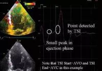 specialty-electrophysiology-tsi-advancedapp.jpg