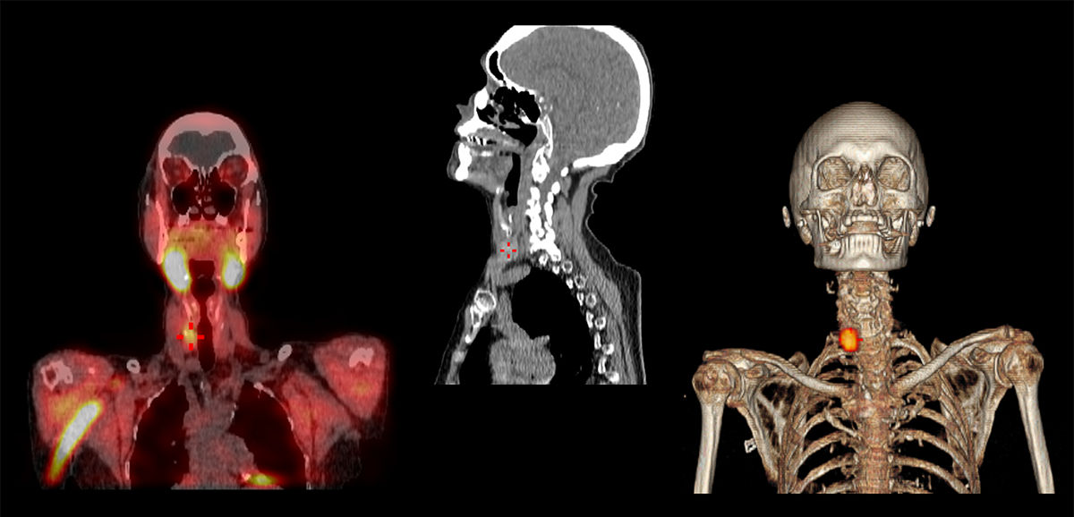 spect-ct-1200